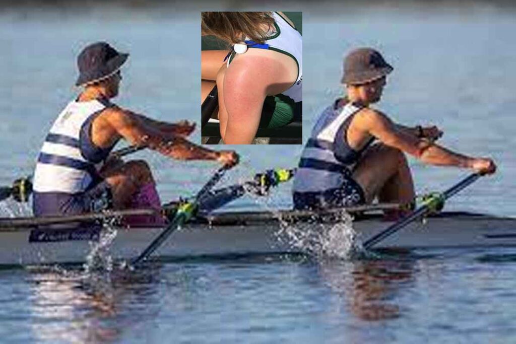 Study recommends better sun protection for young rowers during competition..