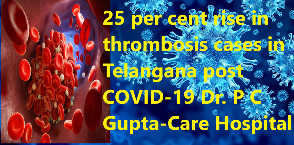 25 per cent rise in thrombosis cases in Telangana post COVID-19
