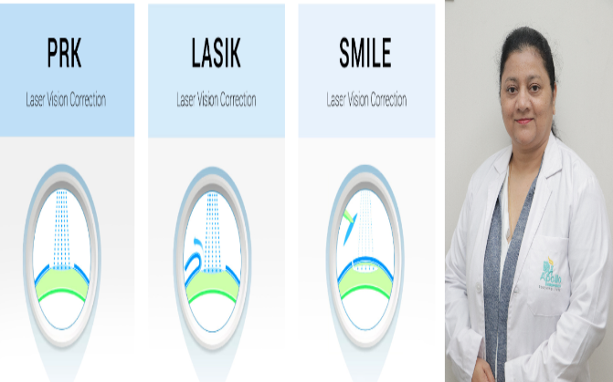 All you should know about Refractive Laser Eye Surgery (SMILE, LASIK, and PRK) - Myths and Facts