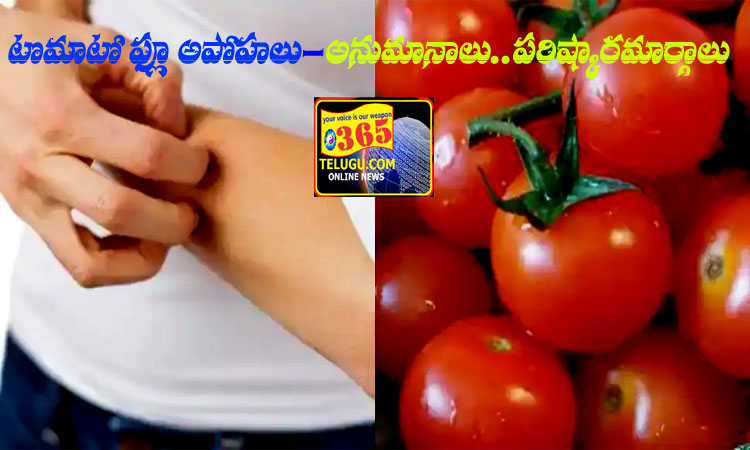 TOMATO FEVER,TOMATO FLU- is similar to HAND FOOT AND MOUTH DISEASE